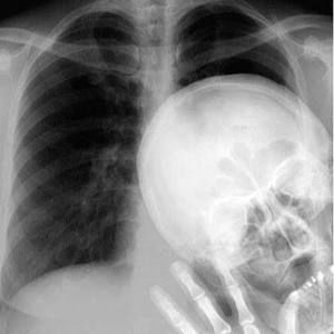 Meet your Posher, Richard